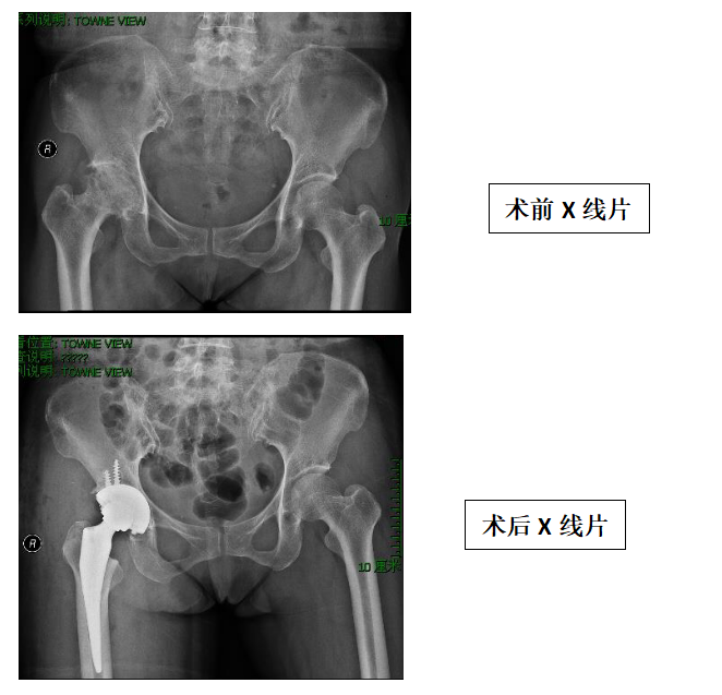 关节、运动医学科特色技术